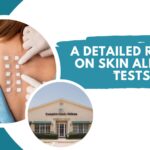 Skin Allergy